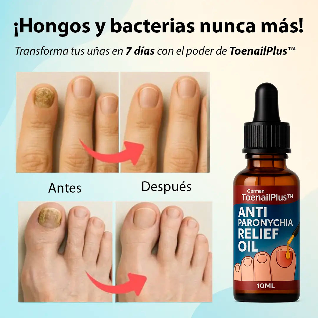 Oferta 2x1 ToenailPlus PRO™ Transforma la salud de tus uñas con una solución efectiva