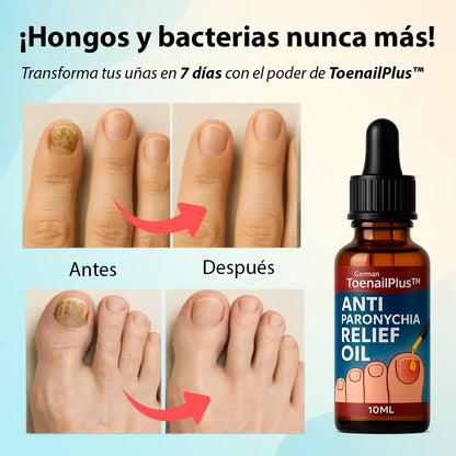 Oferta 2x1 ToenailPlus PRO™ Transforma la salud de tus uñas con una solución efectiva